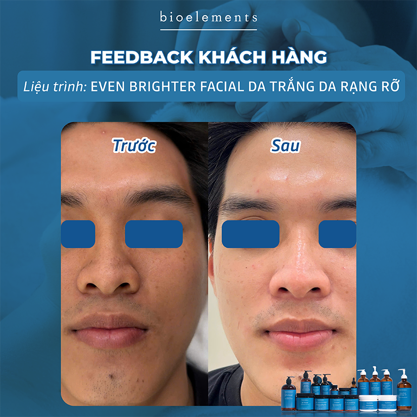 Even Brighter Facial da trang sang rang ro | VietBeauty Success Business