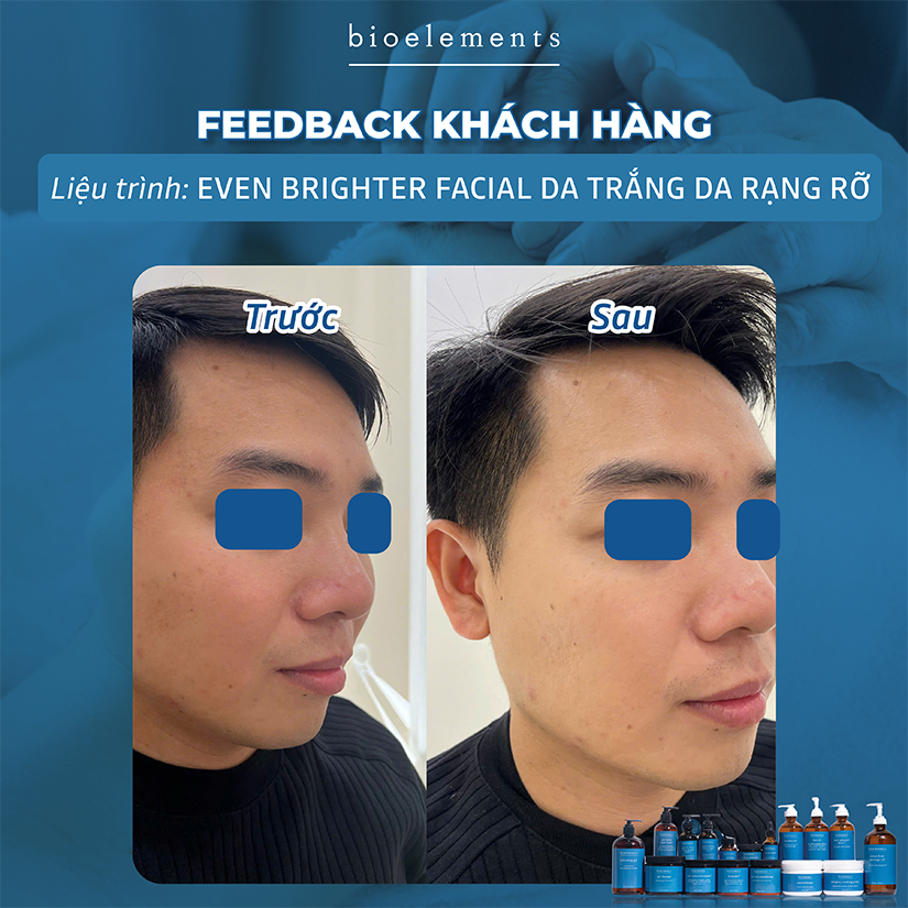 Even Brighter Facial da trang sang rang ro | VietBeauty Success Business