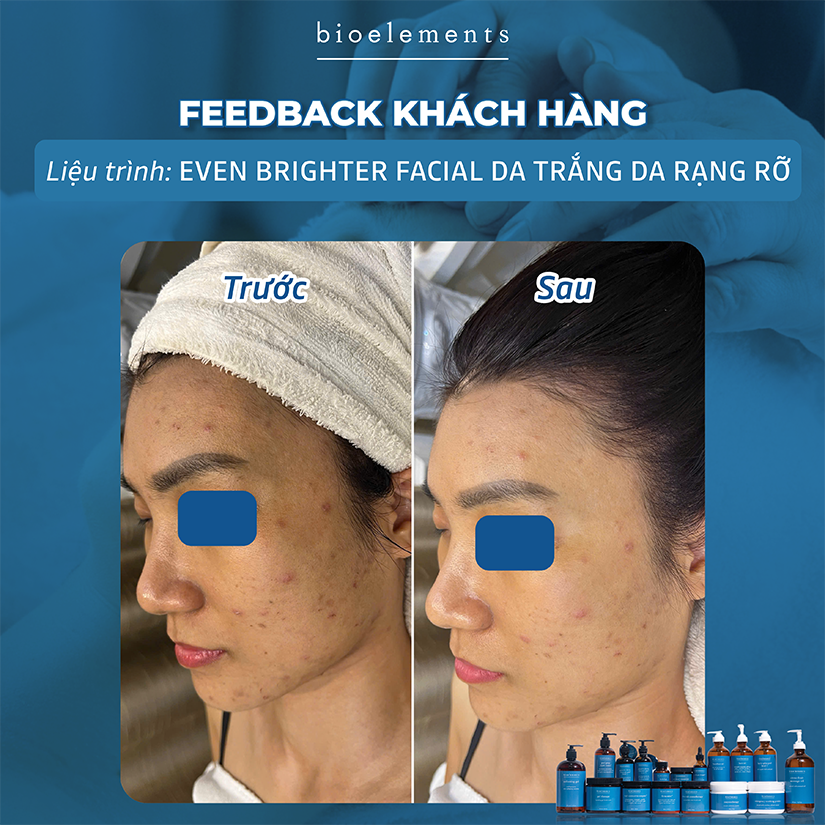 Even Brighter Facial da trang sang rang ro | VietBeauty Success Business