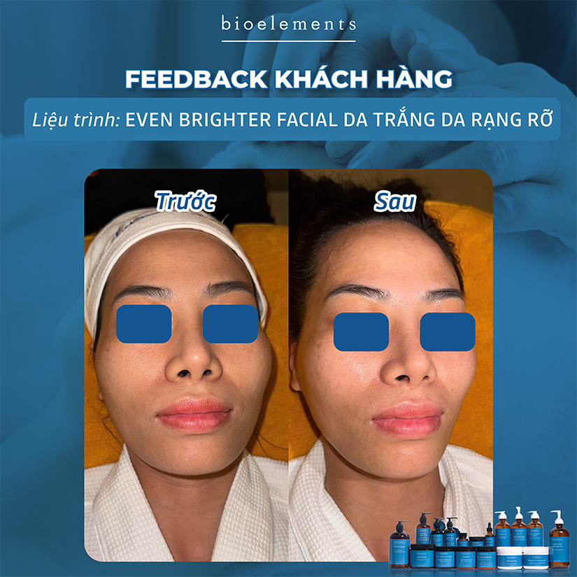 Even Brighter Facial da trang sang rang ro | VietBeauty Success Business