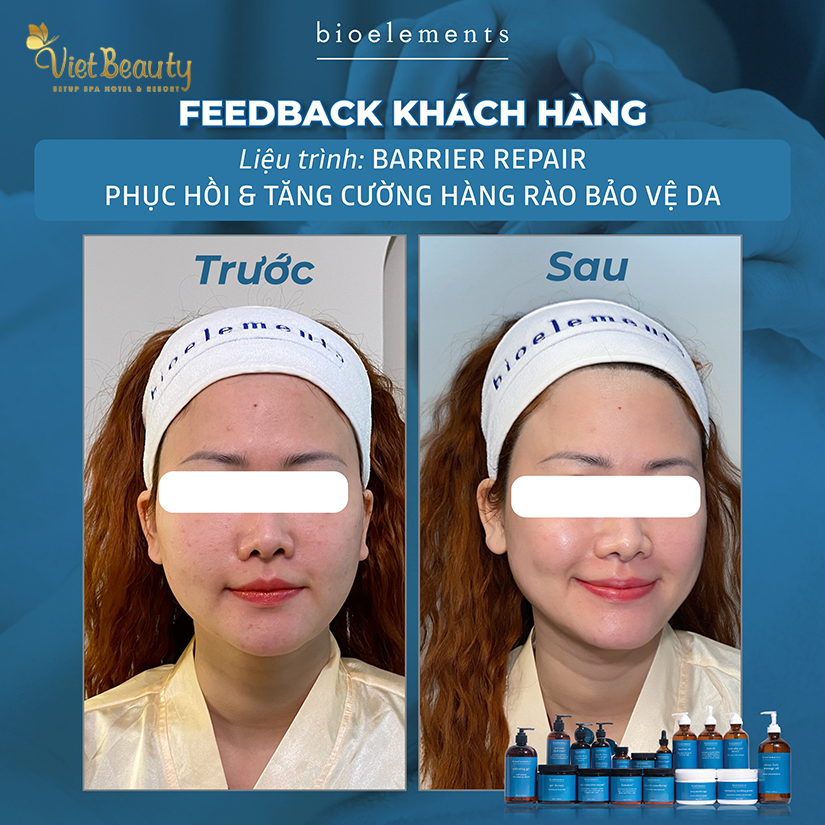  Barrier Repair Relax phục hồi và tăng cường hàng rào bảo vệ da | VietBeauty Success Business