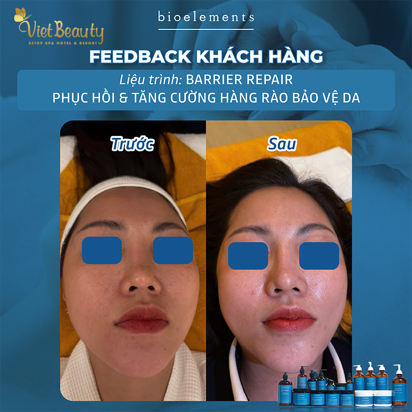  Barrier Repair Relax phục hồi và tăng cường hàng rào bảo vệ da | VietBeauty Success Business