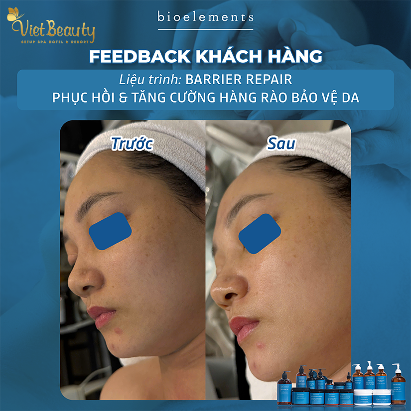  Barrier Repair Relax phục hồi và tăng cường hàng rào bảo vệ da | VietBeauty Success Business