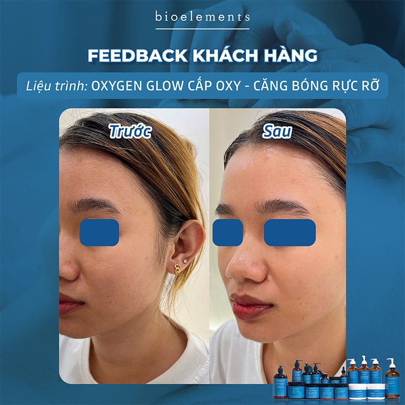 Liệu pháp Oxygen Glow cấp oxy căng bóng rực rỡ | VietBeauty Success Business