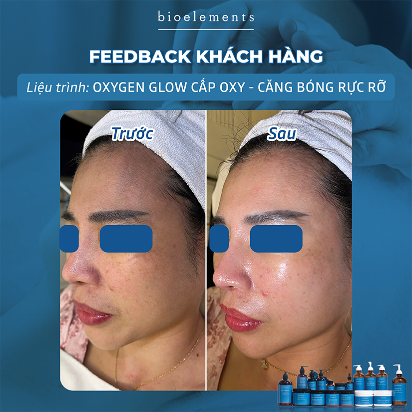 Liệu pháp Oxygen Glow cấp oxy căng bóng rực rỡ | VietBeauty Success Business