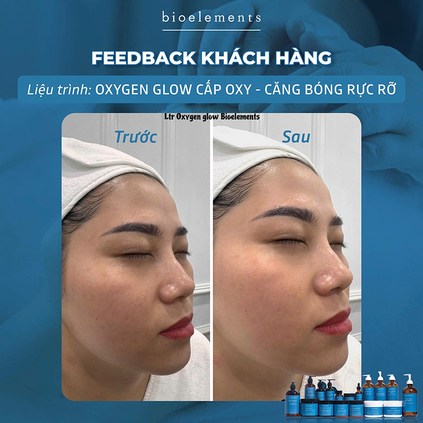 Liệu pháp Oxygen Glow cấp oxy căng bóng rực rỡ | VietBeauty Success Business
